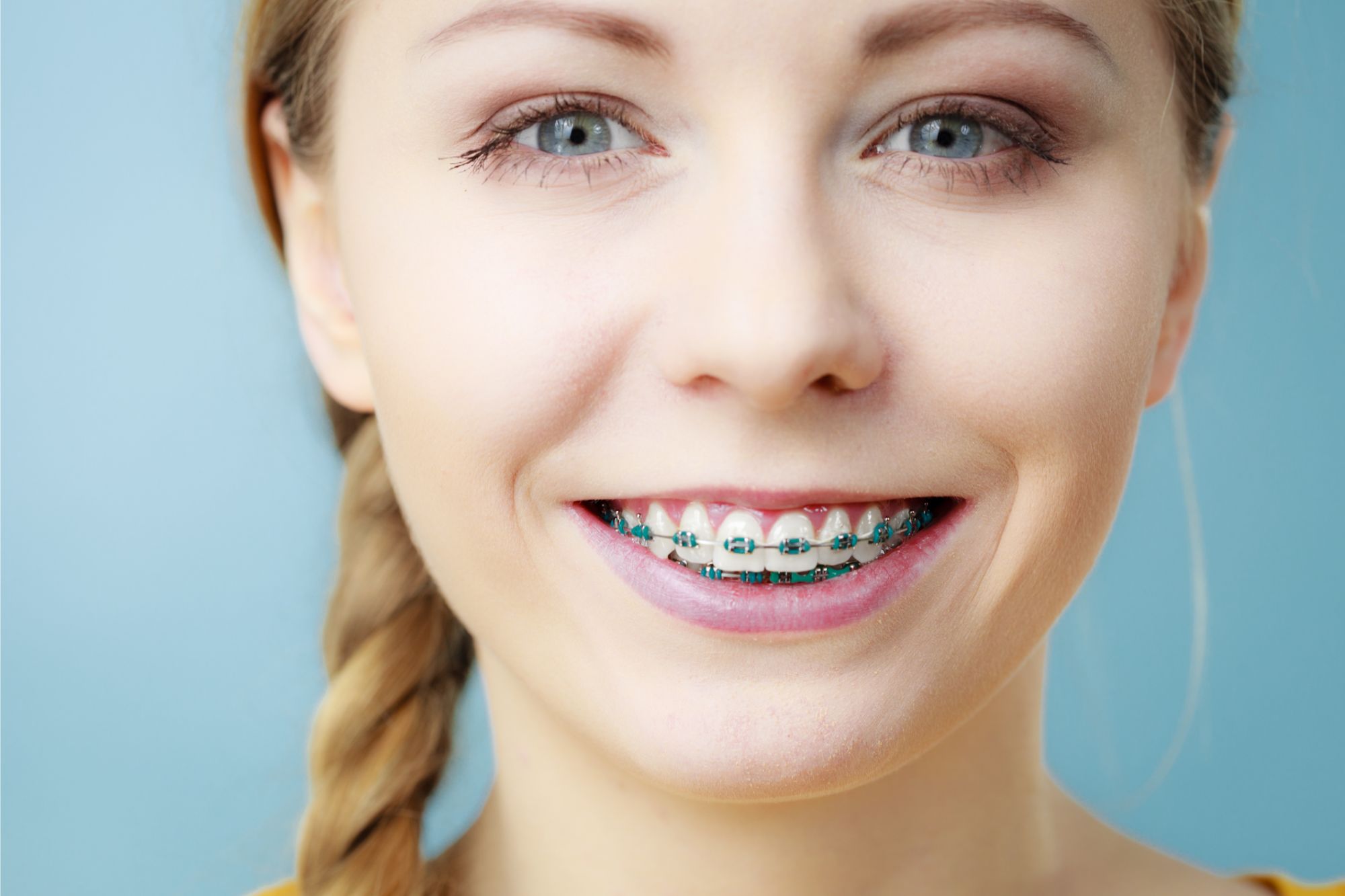 Is It Too Late for Braces? A Guide to Orthodontic Treatment as an Adult
